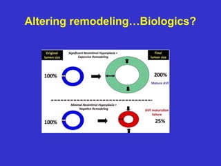 Altering remodeling…Biologics?
 