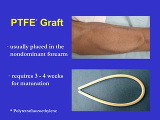 PTFE*
Graft
* Polytetrafluoroethylene
- requires 3 - 4 weeks
for maturation
- usually placed in the
nondominant forearm
 