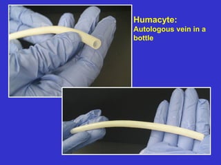 Humacyte:
Autologous vein in a
bottle
 