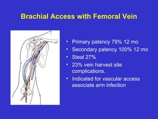 Brachial Access with Femoral Vein
• Primary patency 79% 12 mo
• Secondary patency 100% 12 mo
• Steal 27%
• 23% vein harvest site
complications.
• Indicated for vascular access
associate arm infection
 