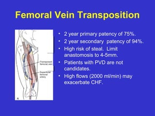 Femoral Vein Transposition
• 2 year primary patency of 75%.
• 2 year secondary patency of 94%.
• High risk of steal. Limit
anastomosis to 4-5mm.
• Patients with PVD are not
candidates.
• High flows (2000 ml/min) may
exacerbate CHF.
 