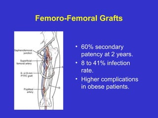 Femoro-Femoral Grafts
• 60% secondary
patency at 2 years.
• 8 to 41% infection
rate.
• Higher complications
in obese patients.
 