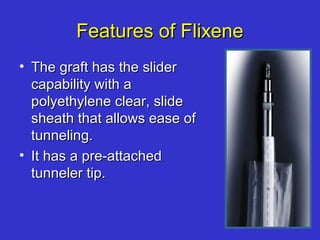 Features of FlixeneFeatures of Flixene
• The graft has the sliderThe graft has the slider
capability with acapability with a
polyethylene clear, slidepolyethylene clear, slide
sheath that allows ease ofsheath that allows ease of
tunneling.tunneling.
• It has a pre-attachedIt has a pre-attached
tunneler tip.tunneler tip.
 