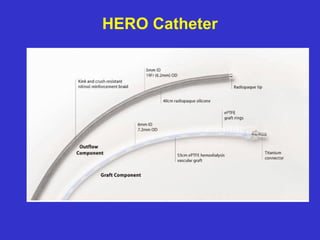 HERO Catheter
 