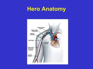 Hero Anatomy
 