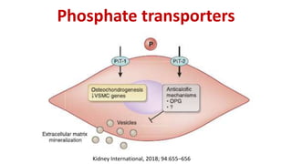 Phosphate transporters
Kidney International, 2018; 94:655–656
 