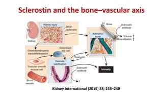Sclerostin and the bone–vascular axis
Kidney International (2015) 88, 235–240
 