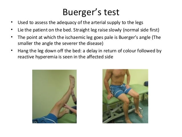supply u Vascular Examination supply u Vascular Examination