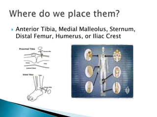 Why do we place them?Short TermWhen all other peripheral access is unavailableWhen condition is unstable and requires hemodynamic monitoring (eg CVP)Prolonged IV TherapyTPN, extended Abx therapy, or caustic medication administration VancomycinDebilitating diseases 	AIDS, CancerLong Term