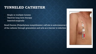 Tac Line Vascular access - venous catheters central.pptx