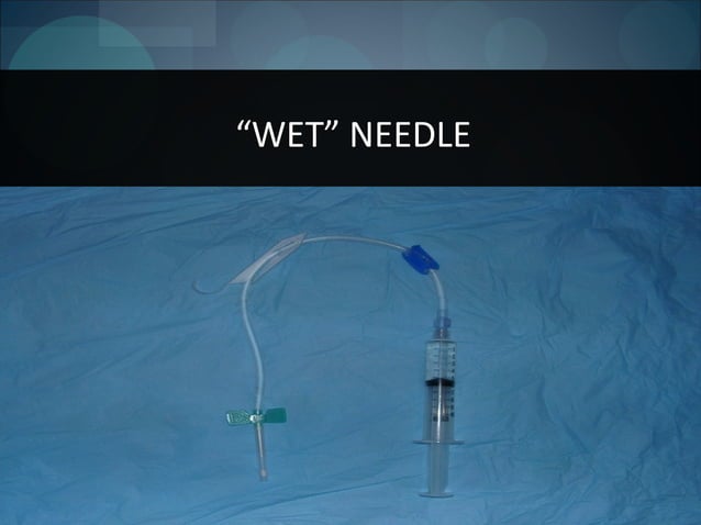 Vascular access for hemodialysis( AVF ) | PPT | First Aid | Injuries