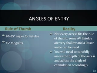 70
Rule of Thumb
20–35° angles for fistulae
45° for grafts
ANGLES OF ENTRY
Reality
Not every access fits the rule
of thumb; some AV fistulae
are very shallow and a lesser
angle can be used
You will need to carefully
assess the depth of the access
and adjust the angle of
cannulation accordingly
 