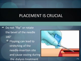 75
Do not “flip” or rotate
the bevel of the needle
180°
Flipping can lead to
stretching of the
needle-insertion site
and cause oozing during
the dialysis treatment
PLACEMENT IS CRUCIAL
 