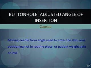 Causes
BUTTONHOLE: ADJUSTED ANGLE OF
INSERTION
90
Moving needle from angle used to enter the skin, arm
positioning not in routine place, or patient weight gain
or loss
 