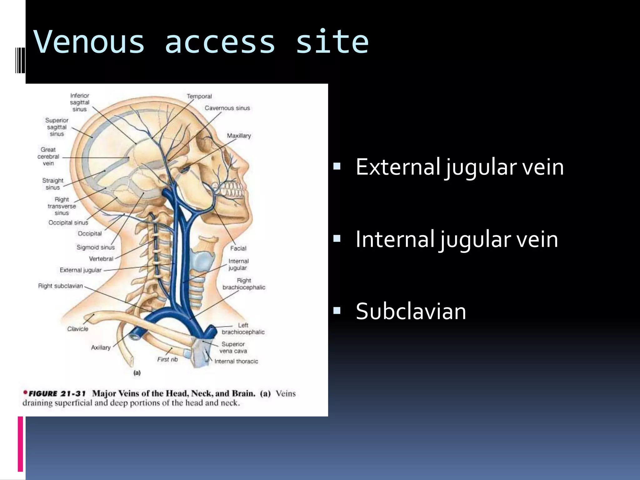 Venous access site


                External jugular vein


                Internal jugular vein


                Subclavian
 
