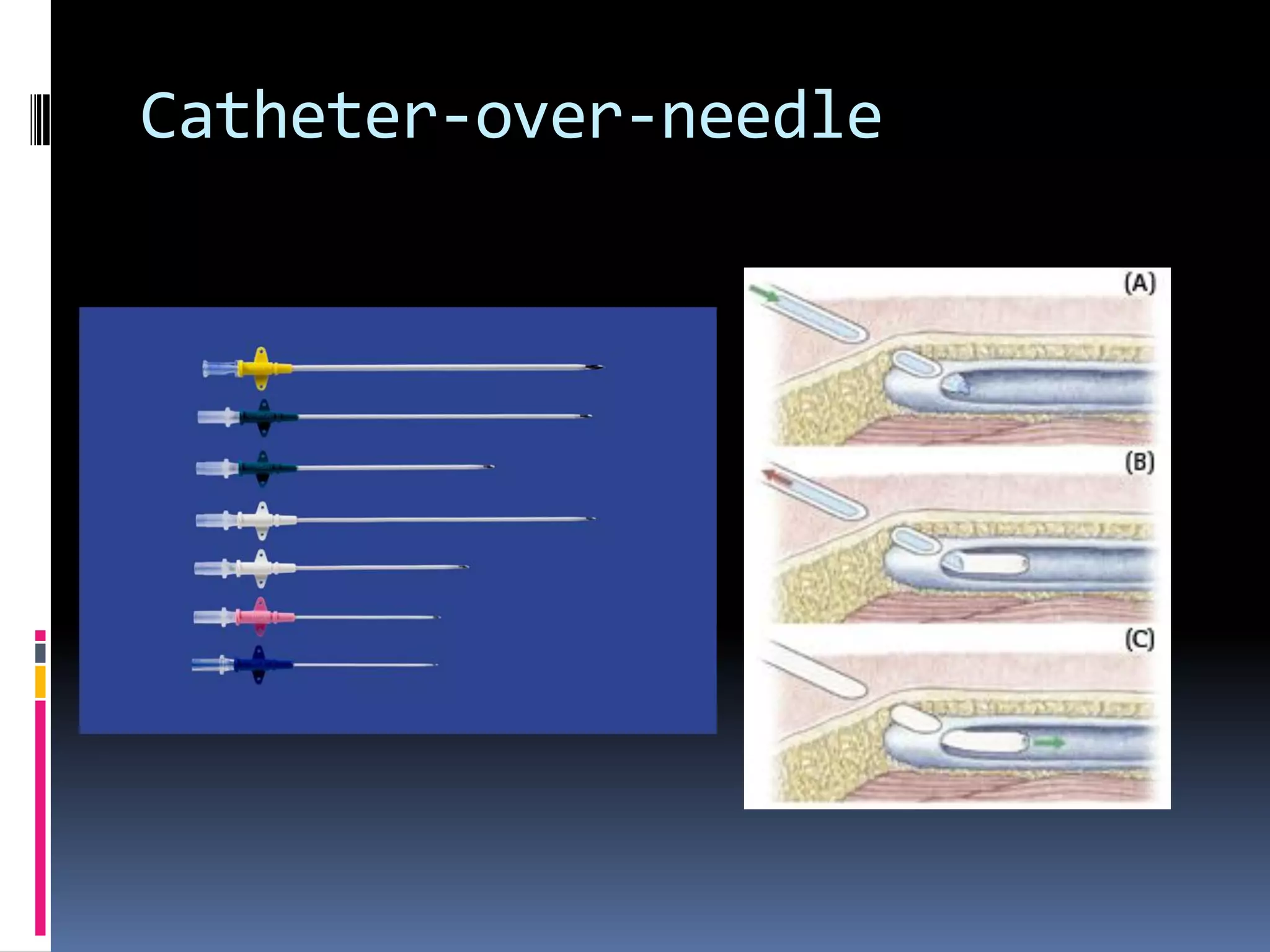 Catheter-over-needle
 