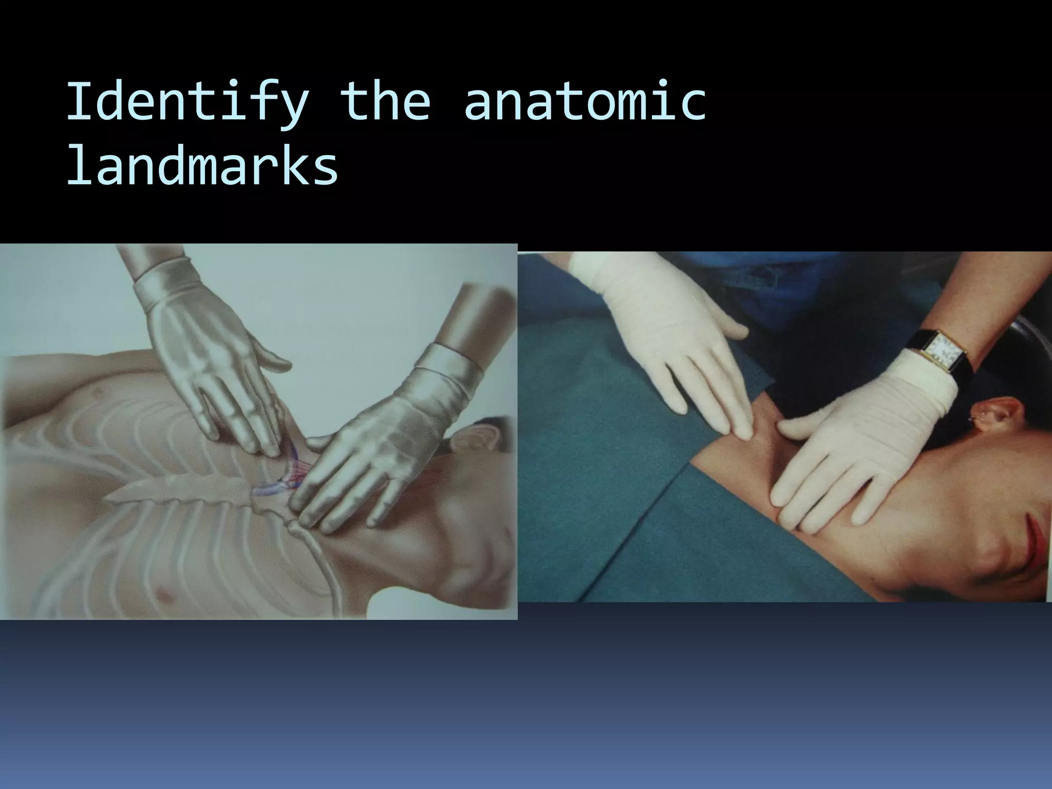 Identify the anatomic
landmarks
 