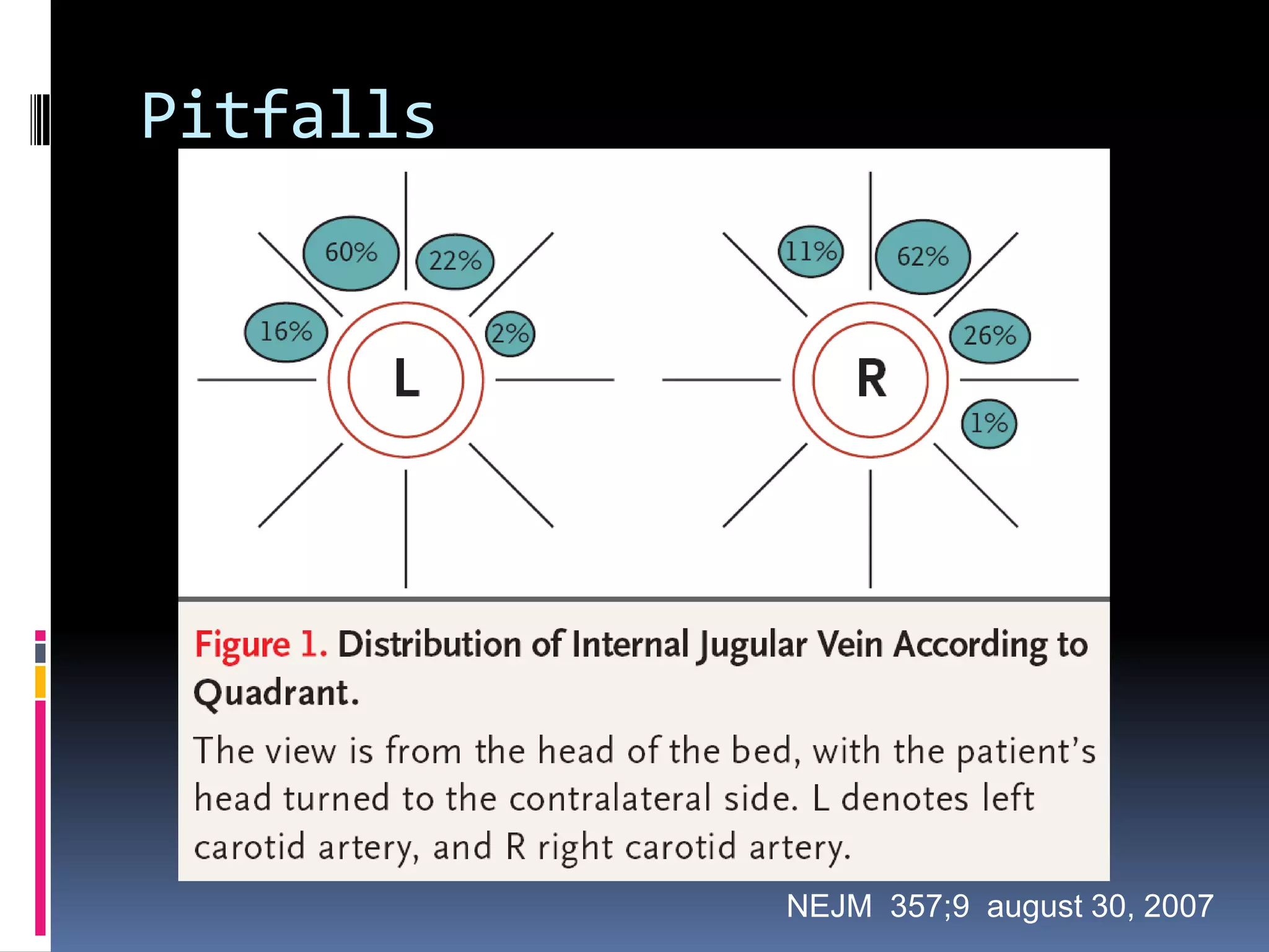 Pitfalls




           NEJM 357;9 august 30, 2007
 