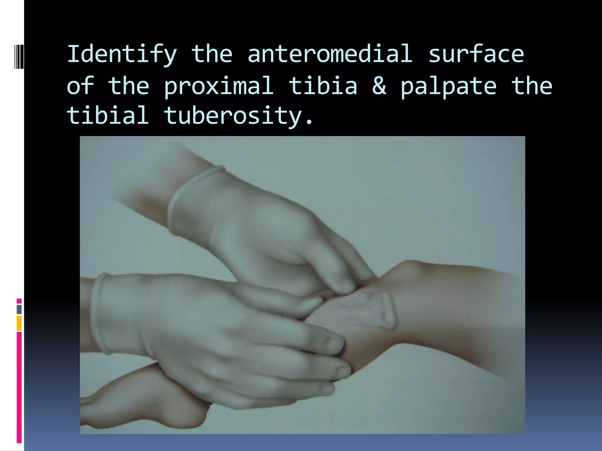 Identify the anteromedial surface
of the proximal tibia & palpate the
tibial tuberosity.
 