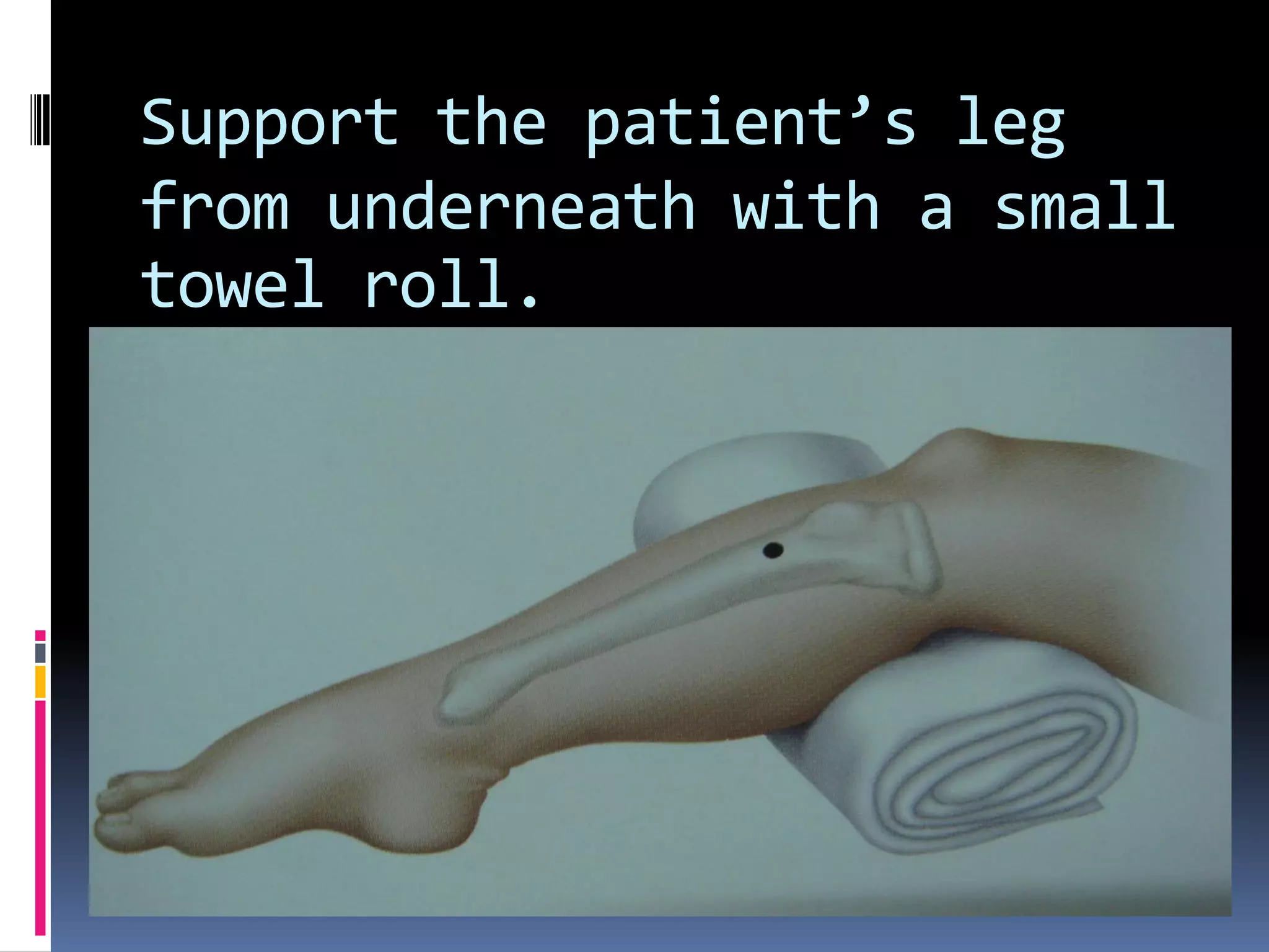 Support the patient’s leg
from underneath with a small
towel roll.
 