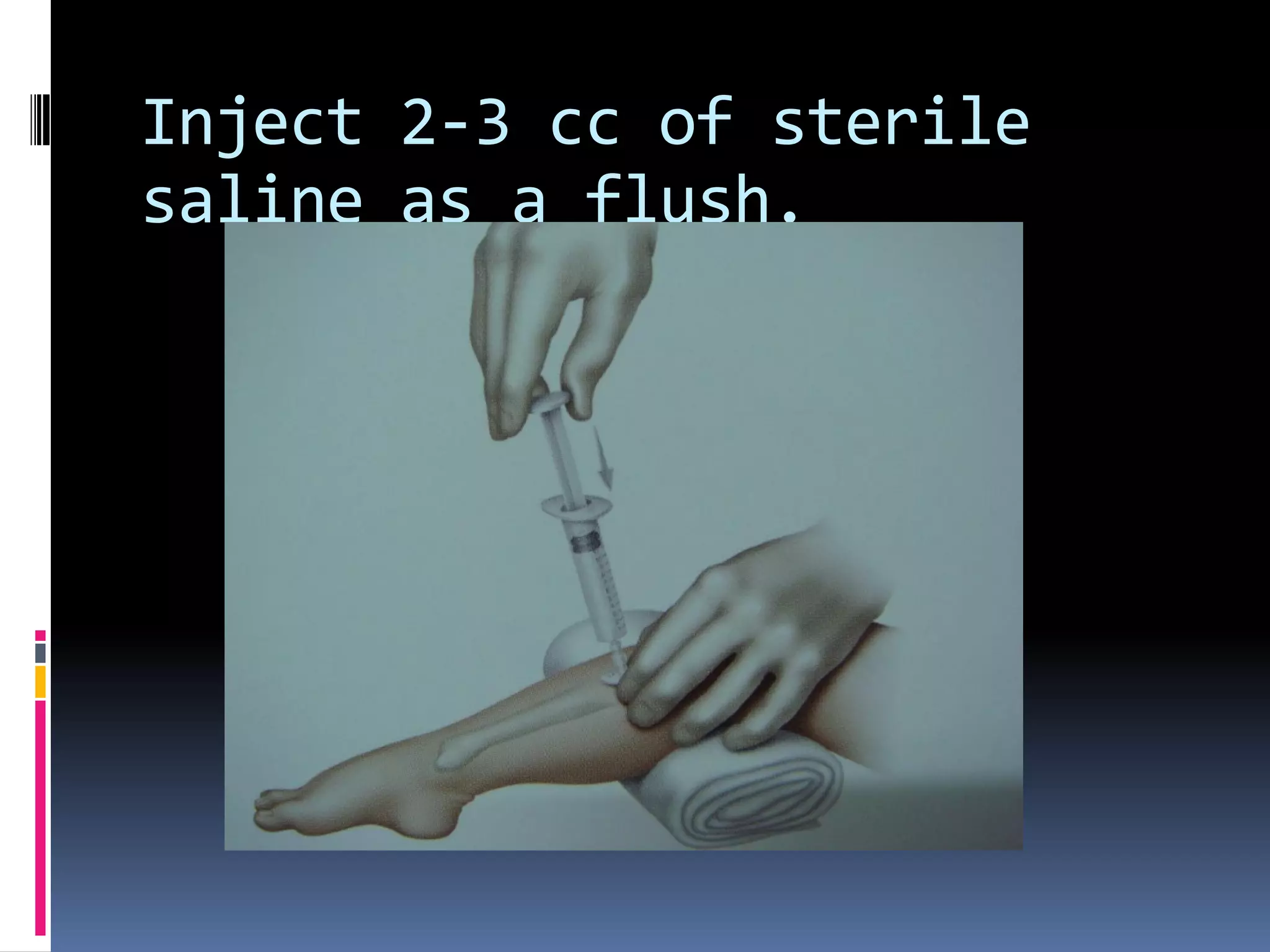 Inject 2-3 cc of sterile
saline as a flush.
 