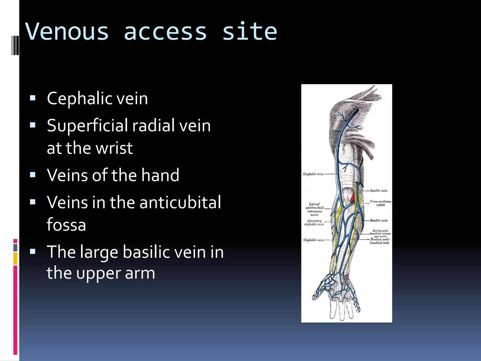 Venous access site

 Cephalic vein
 Superficial radial vein
  at the wrist
 Veins of the hand
 Veins in the anticubital
  fossa
 The large basilic vein in
  the upper arm
 