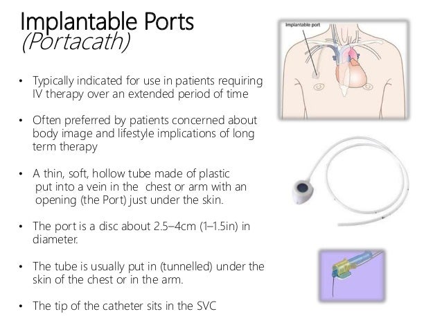 Vascular Access Devices Vascular Access Devices