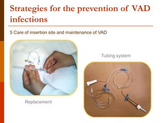 Strategies for the prevention of VAD
infections
5 Care of insertion site and maintenance of VAD
Replacement
Tubing system
 