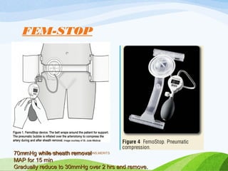 FEM-STOP
VASCULAR ACCESS,COMPLICATIONS,MERITS
116
70mmHg while sheath removal
70mmHg while sheath removal
MAP for 15 min
MAP for 15 min
Gradually reduce to 30mmHg over 2 hrs and remove.
Gradually reduce to 30mmHg over 2 hrs and remove.
 