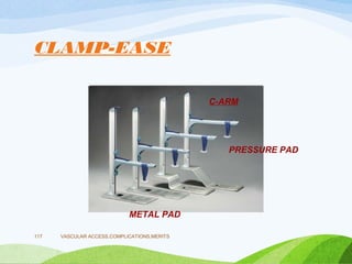 CLAMP-EASE
VASCULAR ACCESS,COMPLICATIONS,MERITS
117
METAL PAD
C-ARM
PRESSURE PAD
 