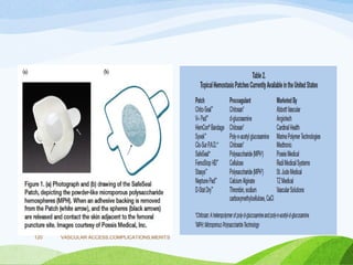 VASCULAR ACCESS,COMPLICATIONS,MERITS
120
 