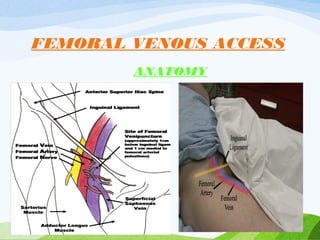 FEMORAL VENOUS ACCESS
ANATOMY
VASCULAR ACCESS,COMPLICATIONS,MERITS
137
 