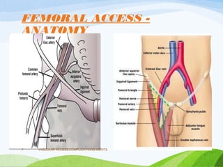 FEMORAL ACCESS -
ANATOMY
VASCULAR ACCESS,COMPLICATIONS,MERITS
7
 