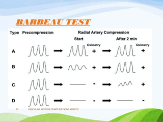 BARBEAU TEST
VASCULAR ACCESS,COMPLICATIONS,MERITS
75
 