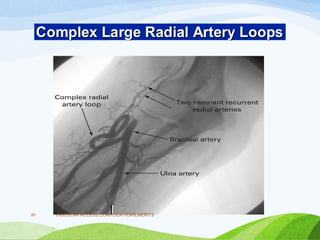 VASCULAR ACCESS,COMPLICATIONS,MERITS
91
 