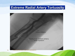 VASCULAR ACCESS,COMPLICATIONS,MERITS
93
 
