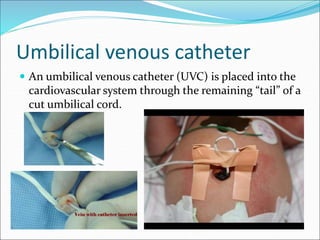 Uvc Course Vascular access in neonates small children dr. rasha helmy | PPTX