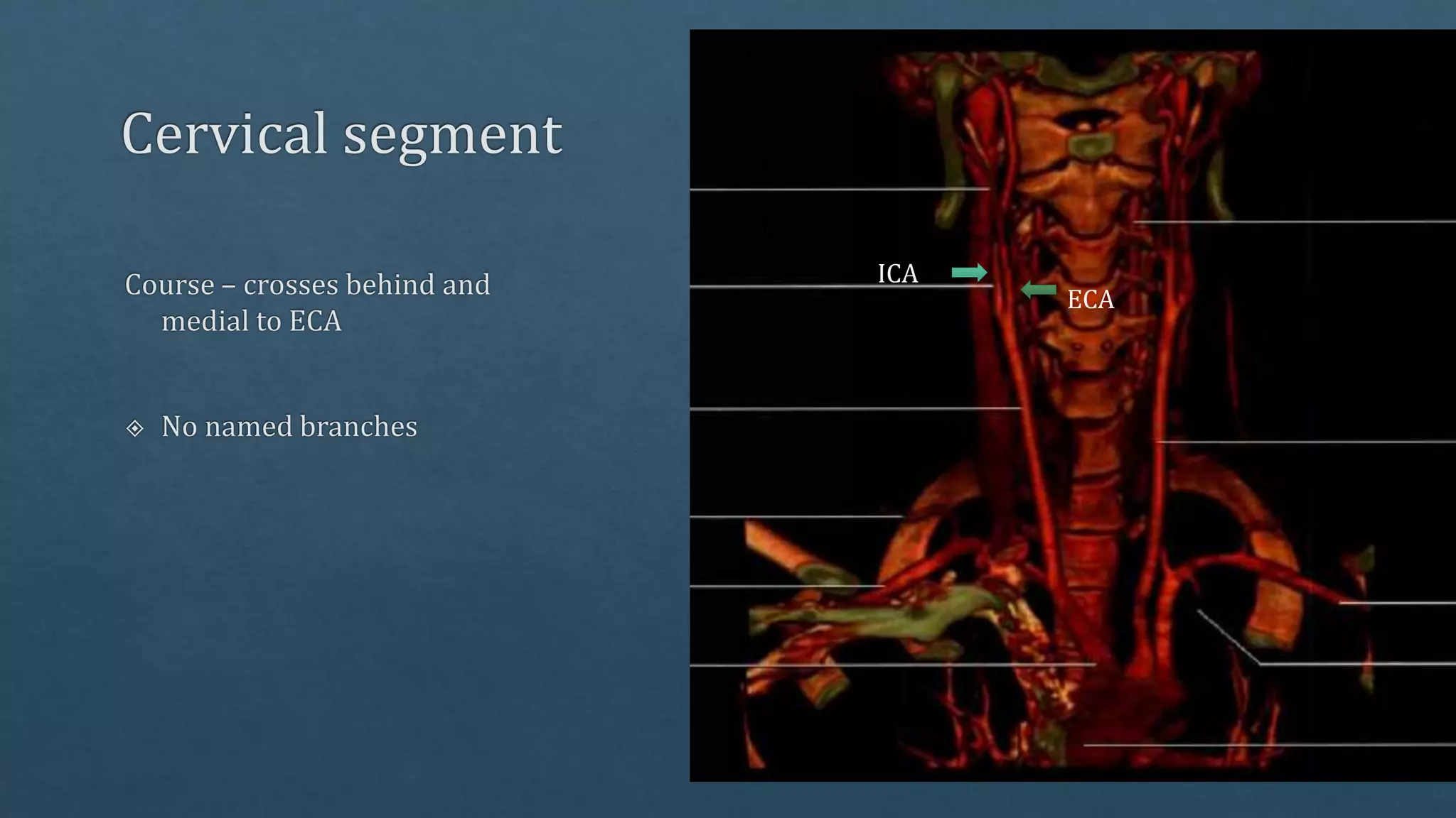Radiological vascular anatomy of brain | PPTX