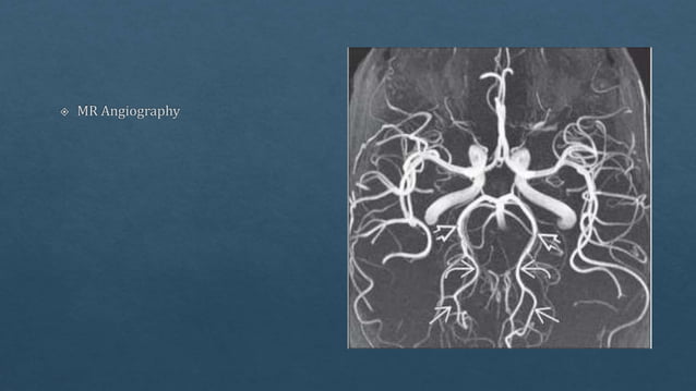 Radiological vascular anatomy of brain | PPTX | Brain and Nervous ...