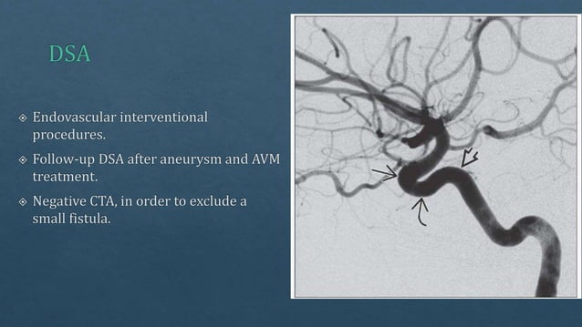 Radiological vascular anatomy of brain | PPTX | Brain and Nervous ...