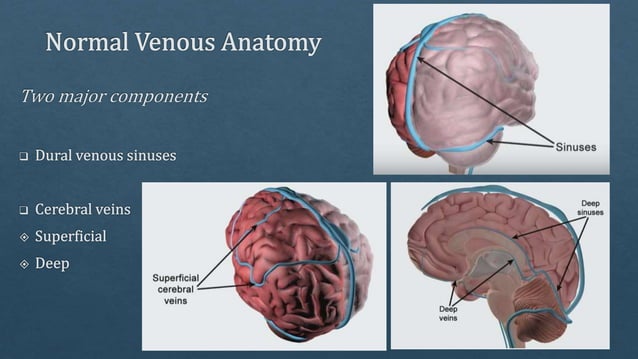 Radiological vascular anatomy of brain | PPTX | Brain and Nervous ...