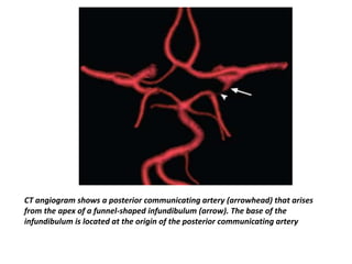imaging and anatomy of blood supply of brain | PPTX