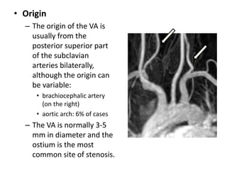 Branches
1. AICA – Anterior Inferior
Cerebellar Artery
– 1st major branch.
– Posterior laterally in
cerebellopontine angle...