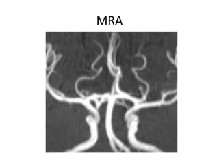 • An association has been observed between
fenestration and aneurysm formation.
• It has been postulated that turbulent fl...