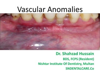 Vascular Anomalies
Dr. Shahzad Hussain
BDS, FCPS (Resident)
Nishtar Institute Of Dentistry, Multan
SNDENTALCARE.Co
 