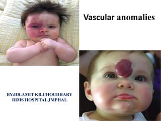 BY:DR.AMIT KR.CHOUDHARY
RIMS HOSPITAL,IMPHAL
Vascular anomalies
 