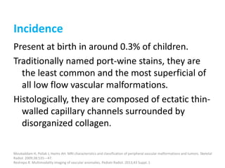 Incidence
Present at birth in around 0.3% of children.
Traditionally named port-wine stains, they are
the least common and the most superficial of
all low flow vascular malformations.
Histologically, they are composed of ectatic thin-
walled capillary channels surrounded by
disorganized collagen.
Moukaddam H, Pollak J, Haims AH. MRI characteristics and classification of peripheral vascular malformations and tumors. Skeletal
Radiol. 2009;38:535---47.
Restrepo R. Multimodality imaging of vascular anomalies. Pediatr Radiol. 2013;43 Suppl. 1
 