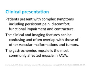Clinical presentation
Patients present with complex symptoms
including persistent pain, discomfort,
functional impairment and contracture.
The clinical and imaging features can be
confusing and often overlap with those of
other vascular malformations and tumors.
The gastrocnemius muscle is the most
commonly affected muscle in FAVA.
Amarneh M, Shaikh R. Clinical and imaging features in fibro-adipose vascular anomaly (FAVA). Pediatr Radiol. 2020;50(3):380-387.
 