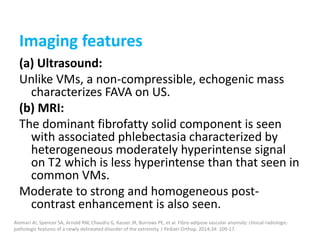 Imaging features
(a) Ultrasound:
Unlike VMs, a non-compressible, echogenic mass
characterizes FAVA on US.
(b) MRI:
The dominant fibrofatty solid component is seen
with associated phlebectasia characterized by
heterogeneous moderately hyperintense signal
on T2 which is less hyperintense than that seen in
common VMs.
Moderate to strong and homogeneous post-
contrast enhancement is also seen.
Alomari AI, Spencer SA, Arnold RW, Chaudry G, Kasser JR, Burrows PE, et al. Fibro-adipose vascular anomaly: clinical-radiologic-
pathologic features of a newly delineated disorder of the extremity. J Pediatr Orthop. 2014;34: 109-17.
 