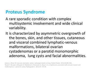 Proteus Syndrome
A rare sporadic condition with complex
multisystemic involvement and wide clinical
variability.
It is characterized by asymmetric overgrowth of
the bones, skin, and other tissues, cutaneous
and visceral combined lymphatic-venous
malformations, bilateral ovarian
cystadenomas or a parotid monomorphic
adenoma, lung cysts and facial abnormalities.
Dubois J, Alison M. Vascular anomalies: what a radiologist needs to know. Pediatr Radiol. 2010;40:895-905.
Nozaki T, Nosaka S, Miyazaki O, Makidono A, Yamamoto A, Niwa T, et al. Syndromes associated with vascular tumors and
malformations: a pictorial review. Radiographics. 2013;33: 175-95.
 